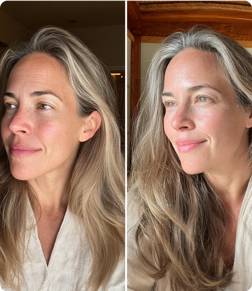 Rachel, 35