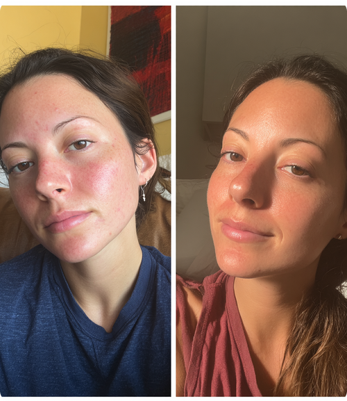 Amanda, 28