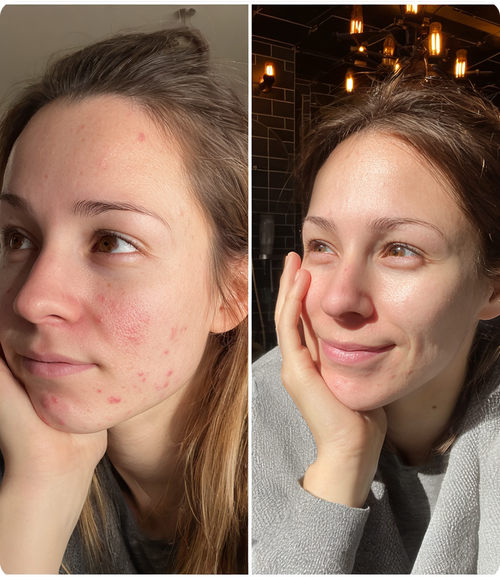 Sarah, 29