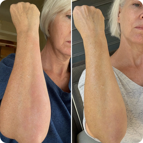 Janet Olsen, 63